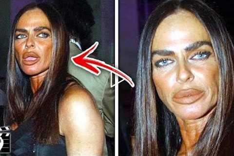Top 10 Celebrities Who Got Botched From BAD Plastic Surgery