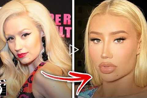 Top 10 Celebrities Who INSTANTLY Regretted Their Plastic Surgery