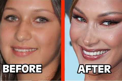 Top 10 Celebrities Who've Gotten BOTCHED From Cat Eye Surgery