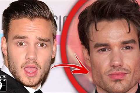 Top 10 Celebrities Who DESTROYED Their Face With Plastic Surgery