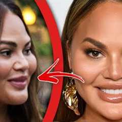 Top 10 Celebrities Who DESTROYED Their Face With Filler